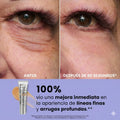 tensor ojos