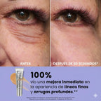 tensor ojos