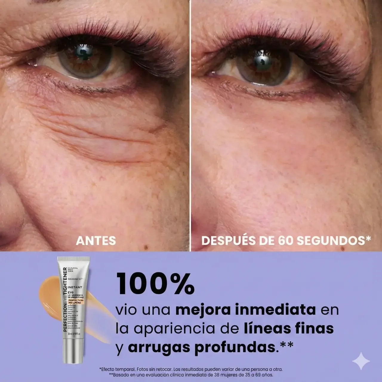 tensor ojos