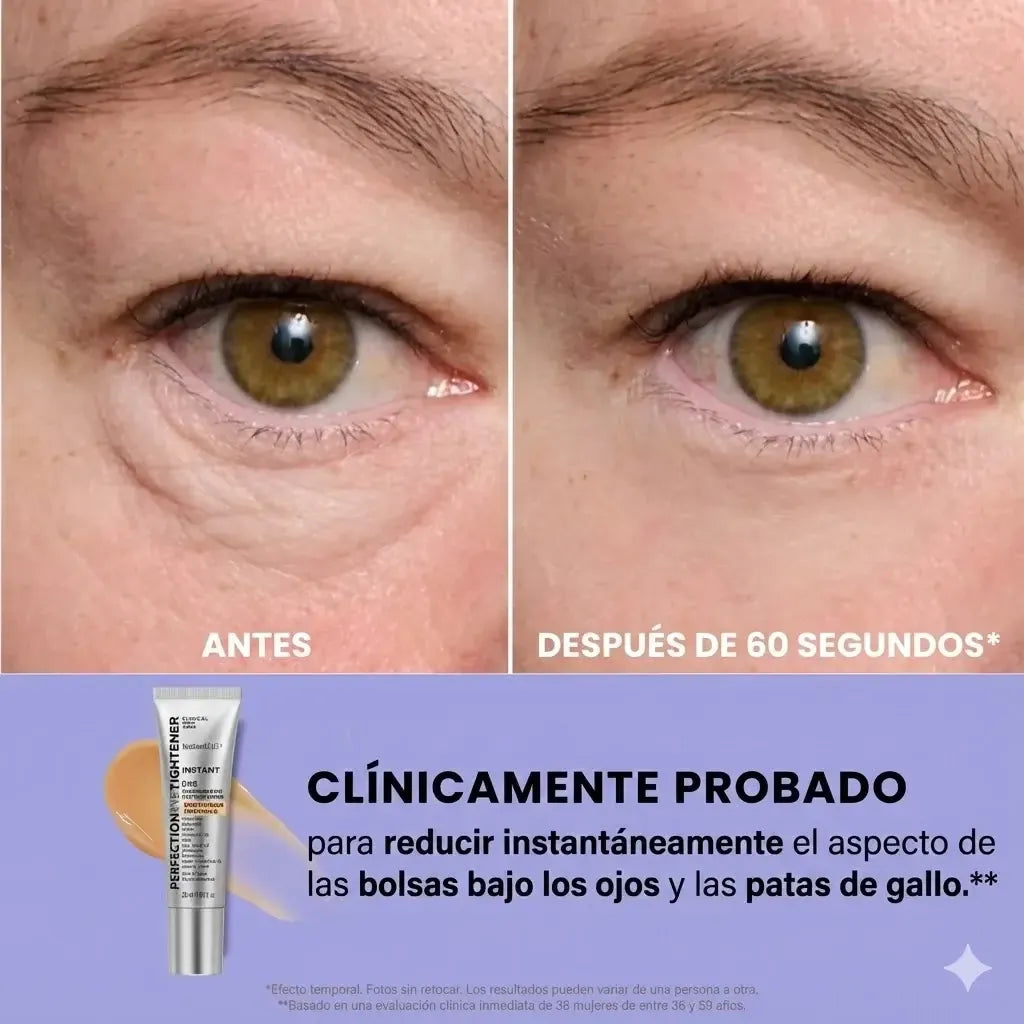 tensor ojos